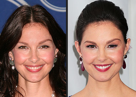 Ashley Judd in 2012 and 2006 Criticism of her puffy face 