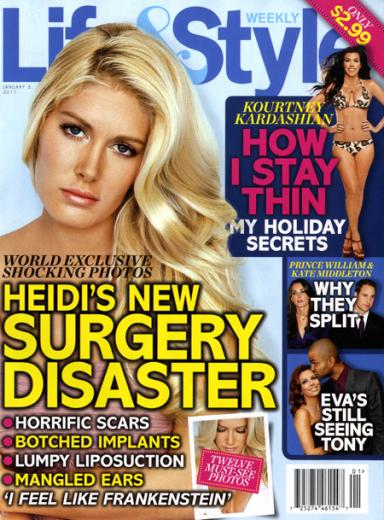 Heidi Montag Surgery Disaster