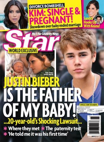 Justin Bieber Star Magazine Cover