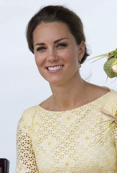 Kate Middleton Teeth
