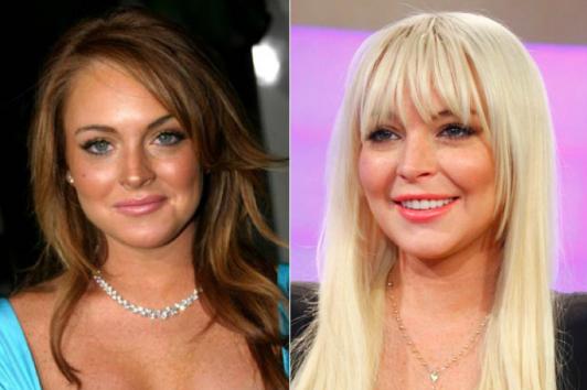 Lindsay Lohan Plastic Surgery?